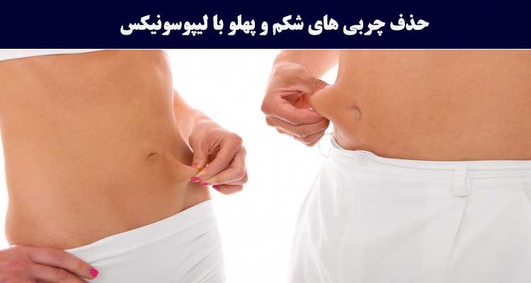 لاغری موضعی شکم با دستگاه لیپوسونیکس - تبریزپوست