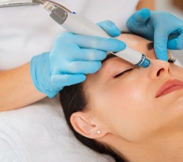 میکرونیدیلینگ صورت در تبریز