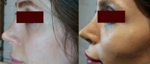 گونه گذاری در تبریز