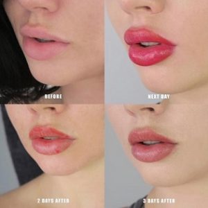 شیدینگ لب برای چه افرادی مناسب است؟