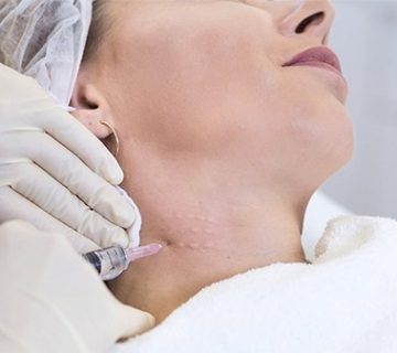 جوانسازی پوست گردن در تبریز