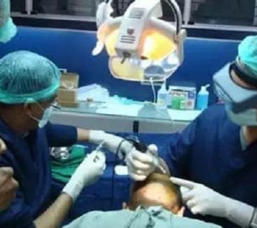 بهترین کلینیک کاشت مو در تبریز