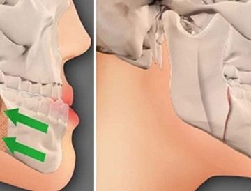 جراحی فک در تبریز