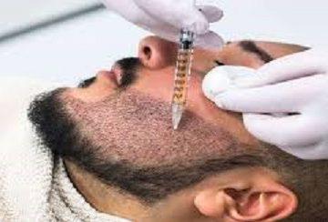 مزوتراپی ریش در تبریز